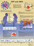 HIV and AIDS - Anatomical Chart